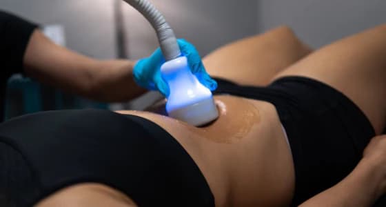 Cryo Toning